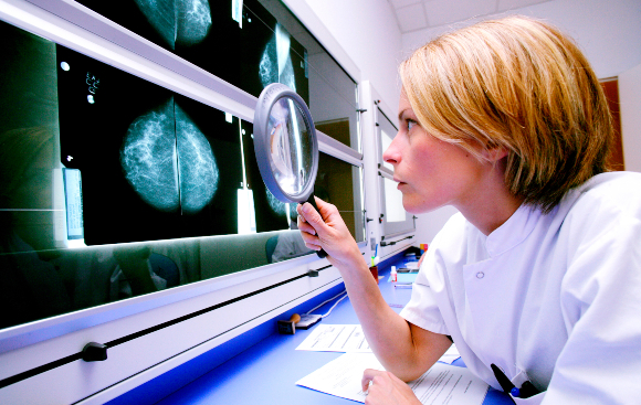  רופאה בוחנת צילומים של גידולי שד | צילום: BURGER / PHANIE / SCIENCE PHOTO LIBRARY