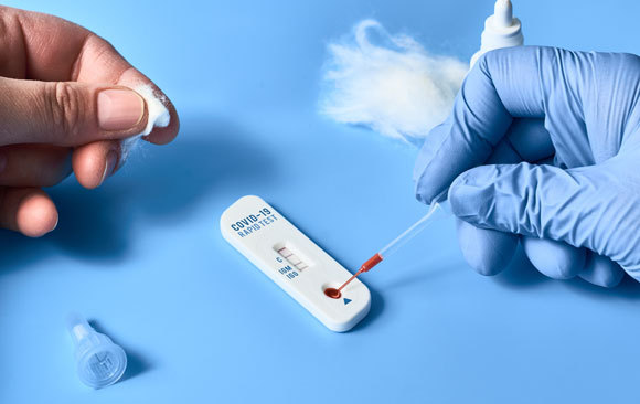 בדיקה סרולוגית | צילום: anyaivanova, Shutterstock