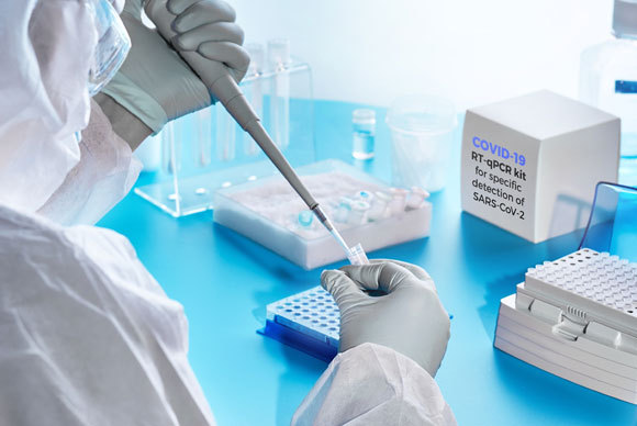 בדיקת מעבדה לקורונה | צילום: anyaivanova, Shutterstock