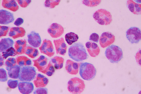 הגלים שמסייעים למוח לנקות את הפסולת? נוזל מוחי-שדרתי | צילום: Shutterstock