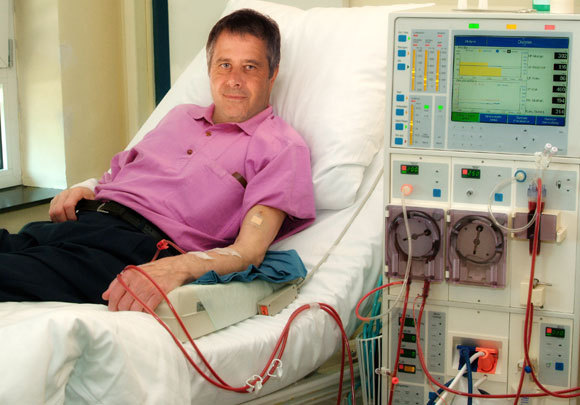 גם אם הסיכון כפול, ההבדל בתחלואה יכול להיות קטן. חולה כליות בטיפול דיאליזה | צילום: gopixa, Shutterstock