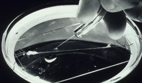 חוקר בוחן אקסון ענק של דיונון | NIH History Office