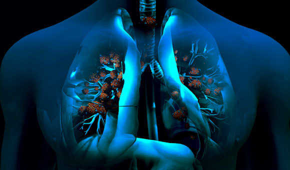 הנגיף תוקף את תוקף את התאים בריאות. איור: DESIGN CELLS / SCIENCE PHOTO LIBRARY