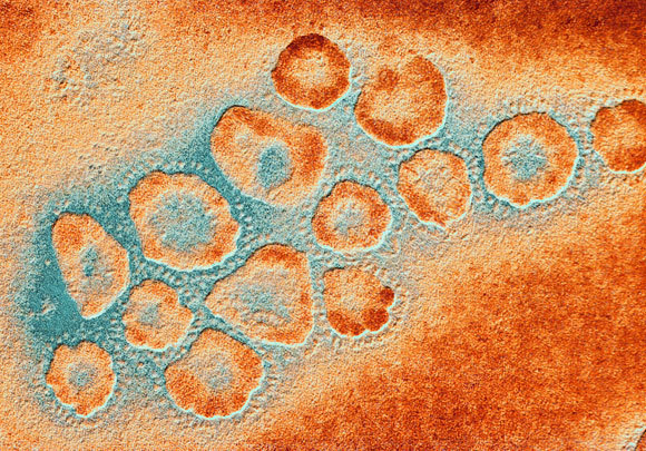 תמונת מיקרוסקופ אלקטרונים של נגיפי קורונה | Alfred Pasieka, SPL