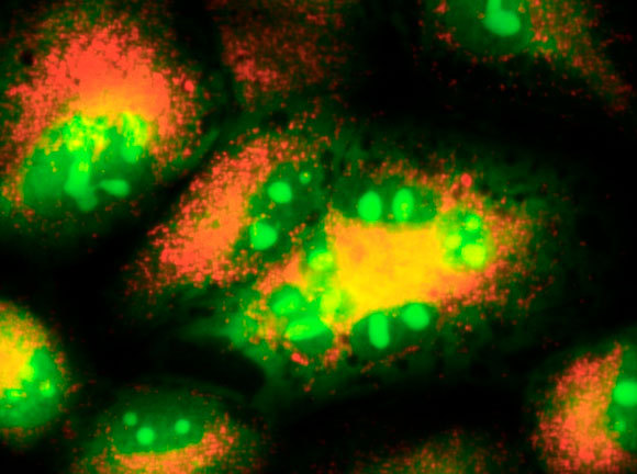 תמונה של תהליך אוטופגיה בתאי סרטן הריאות. צילום: SPL