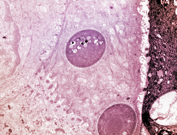 תאי פטריית הכיטריד Bd על עור של דו-חי, צילום במיקרוסקופ אלקטרונים | מקור: Science Photo Library