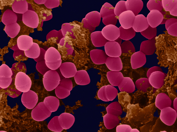 האוכלוסייה מתחילה להיווצר כבר בעת הלידה. חיידקים במעיים (צילום צבוע במיקרוסקופ אלקטרונים) | צילום: Science Photo Library