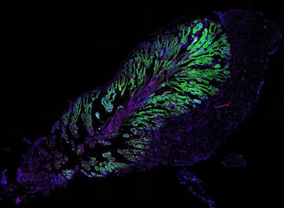 תאים שונים בבלוטת ארס של נחש מייצרים רעלנים שונים, פה צבועים בכחול וירוק | קרדיט: Joep Beumer, Yorick Post, Jens Puschhof, © Hubrecht Institute
