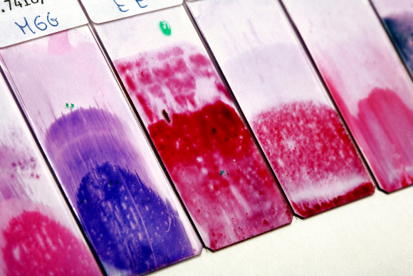 לוחיות של משטח פאפ | איור: Science Photo Library