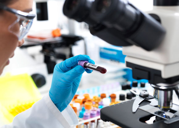 בדיקה של דגימות דם | צילום אילוסטרציה: Science Photo Library