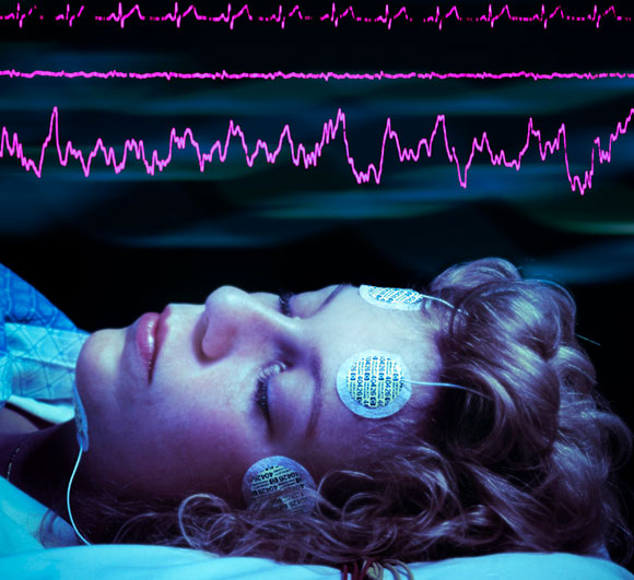 אישה ישנה עם אלקטרודות על מצחה, גלי מוח מעליה | SPL