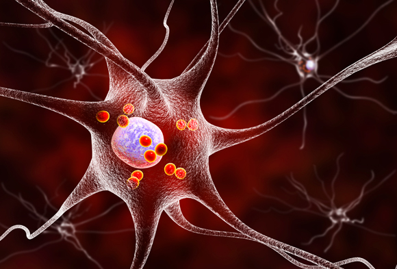 תאי עצב במוח של חולי פרקינסון | איור: Science Photo Library