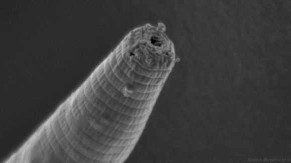 כושר עמידות מרשים. תולעת השטן | צילום במיקרוסקופ: Gaetan Borgonie, Extreme Life Isyensya, Gentbrugge, Belgium