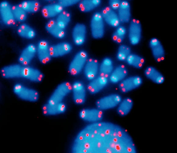 טלומרים (באדום) בקצות כרומוזומים אנושיים | SPL, NCI Center For Cancer Research