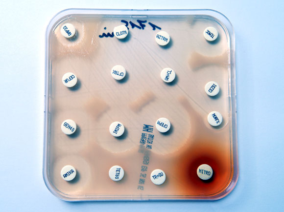 עמידות במהירות שיא, כנראה בגלל מינון נמוך. בדיקת עמידות לאנטיביוטיקות שונות | צילום: Science Photo Library