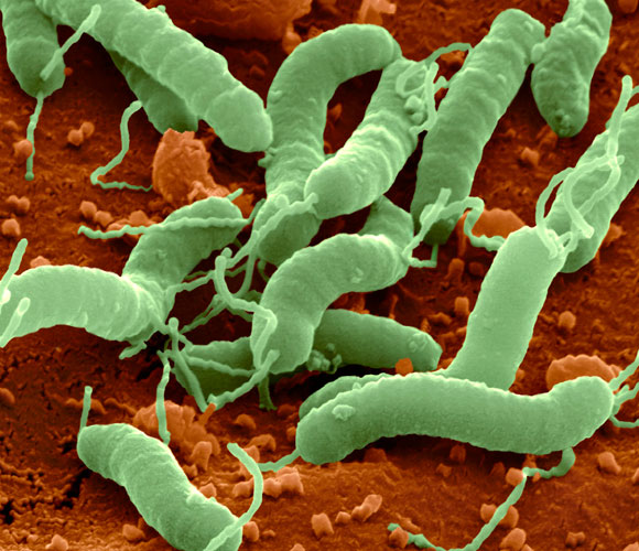 הכפילו את שיעור החיידקים העמידים. חיידקי הליקובקטר במיקרוסקופ אלקטרונים | מקור: Science Photo Library