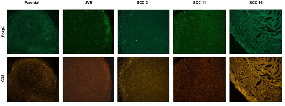 גידולים הומוגניים (SCC) מראים תגובה חיסונית חזקה יותר מגידול הטרוגני (UVB) | צילום במיקרוסקופ פלואורסצנטי: סופי טרביז'