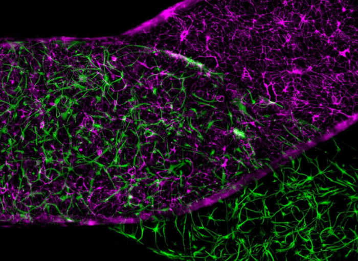 המחסום על שבב של וטין וסוונדסן משלב תאי אנדותל (סגול) ואסטרוציטים (ירוק) | מקור: Cedars-Sinai/Cell Stem Cell