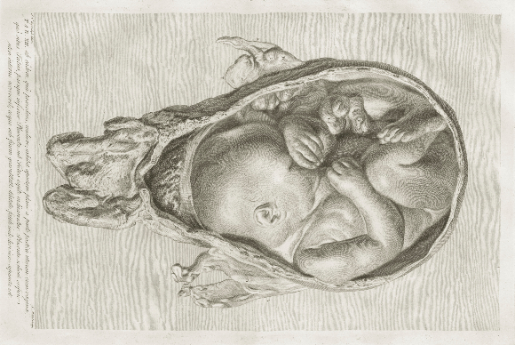 עובר ברחם - כבר לא סטרילי. רישום של הרופא הסקוטי ויליאם הנטר מ-1774. מקור: Science Photo Library