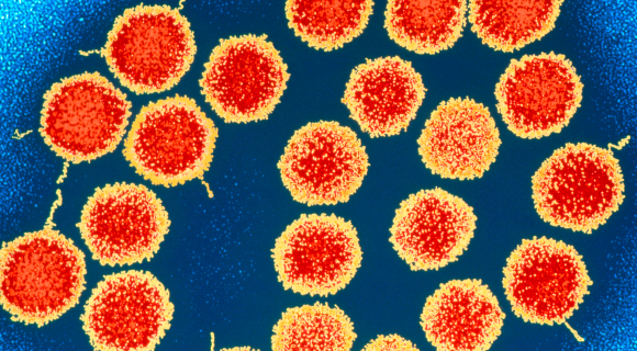 מחדירים לתאי העצב עותקים תקינים של הגנים. נגיפים מהונדסים | מקור: Science Photo Library