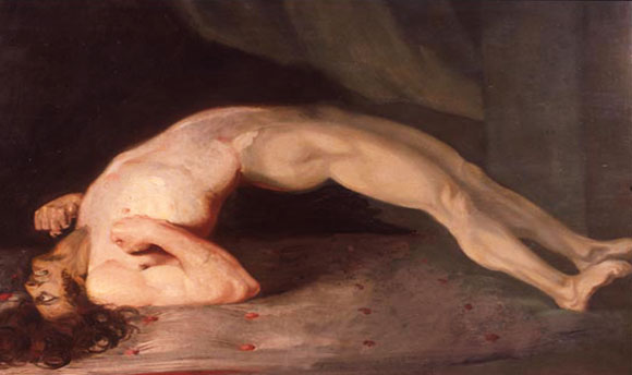 צפידה חמורה אצל חולה טטנוס | ציור של סר צ'רלס בל מ-1809 | מקור: ויקיפדיה, נחלת הכלל