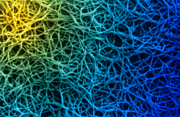 חיידקי Fusobacterium nucleatum השכיחים יותר אצל חולי סרטן. צילום מיקרוסקופ אלקטרונים צבוע | Science Photo Library
