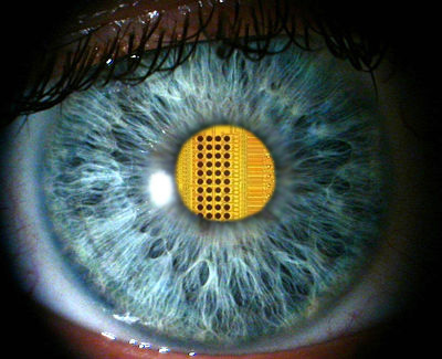 תמונת עין ביונית עם שבב בתור אישון | Scientific American