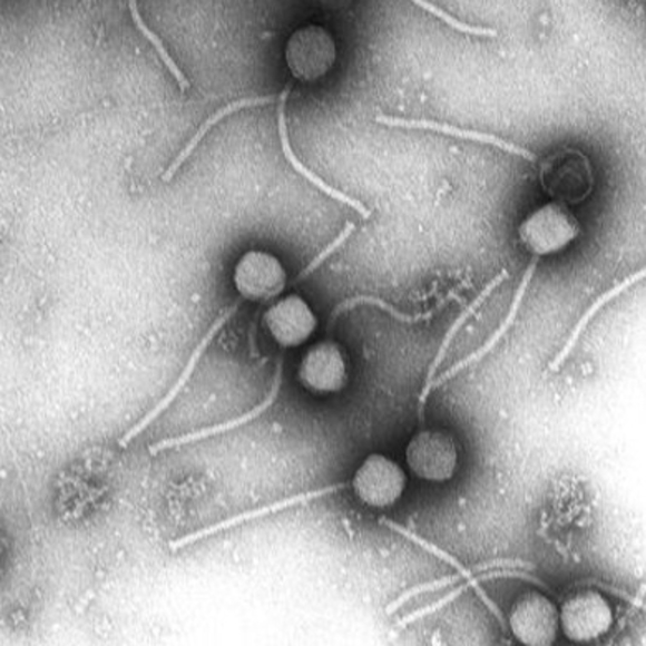 צילום מיקרוסקופ של בקטריופאג'ים. קרדיט:Scientific American |  Wikimedia Commons/PLoS One/Vincent Fischetti and Raymond Schuch, The Rockefeller University 