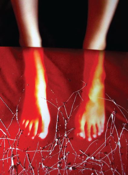 אילוסטרציה כאבים כרוניים עזים מחלת הגפיים האדומות. קרדיט: ג'ראלד סלוטה | Scientfic American 