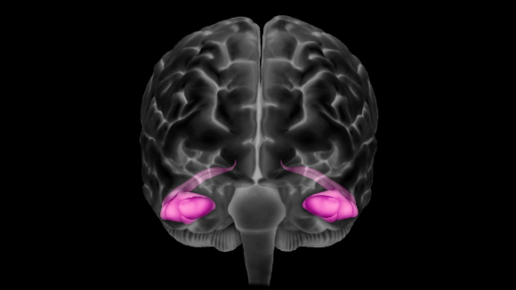 האימון הגופני משפר את הביצועים בכמה אזורים נפרדים: ההיפוקמפוס (ורוד) בהדמיית מוח | Science Photo Library