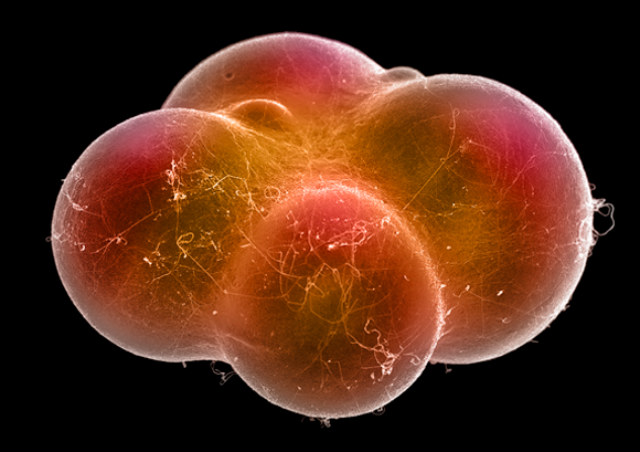 H19 גרם לעלייה במטבוליזם. תאי שומן בצילום במקירוסקופ אלקטורנים סורק | מקור: Science Photo Library