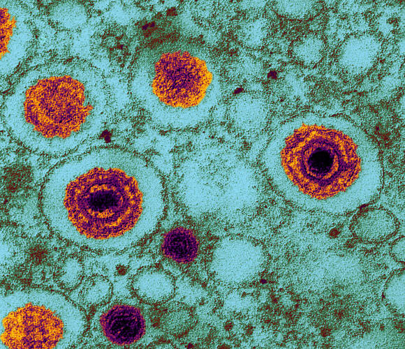 מחזקים רשתות עצבים באופן שמאיץ את הידרדרות המוח. נגיפי הרפס | צילום במיקרוסקופ אלקטרונים: Science Photo Library