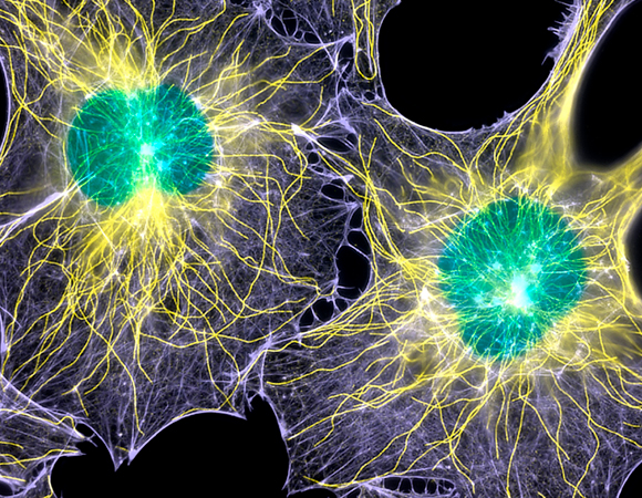 תאי פיברולסט, בצביעה שמראה את השלד שלהם | Science Photo Library