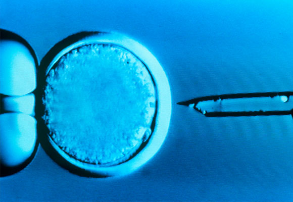 הוצאת חומר גנטי מביצית למטרות שיבוט | Science Photo Library