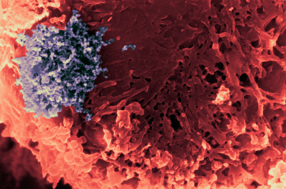 תא T מודבק בנגיף HTLV, צילום צבוע במיקרוסקופ אלקטרונים סורק | מקור: Science Photo Library