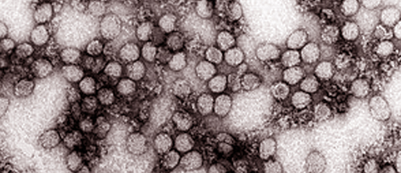 אין תרופה, אבל יש דרכי מניעה וחיסון יעיל. צילום במיקרוסקופ של נגיפי קדחת צהובה מקור: ויקיפדיה, נחלת הכלל