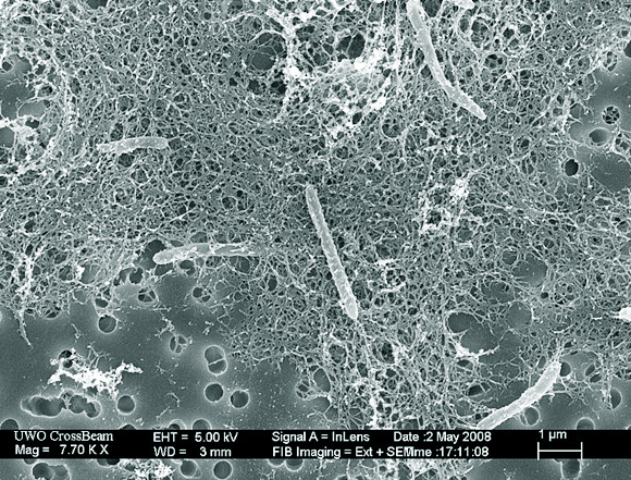 מושבה של חיידקי Desulforudis audaxviator, צילום במיקרוסקופ אלקטרונים | מקור: ויקיפדיה, נחלת הכלל