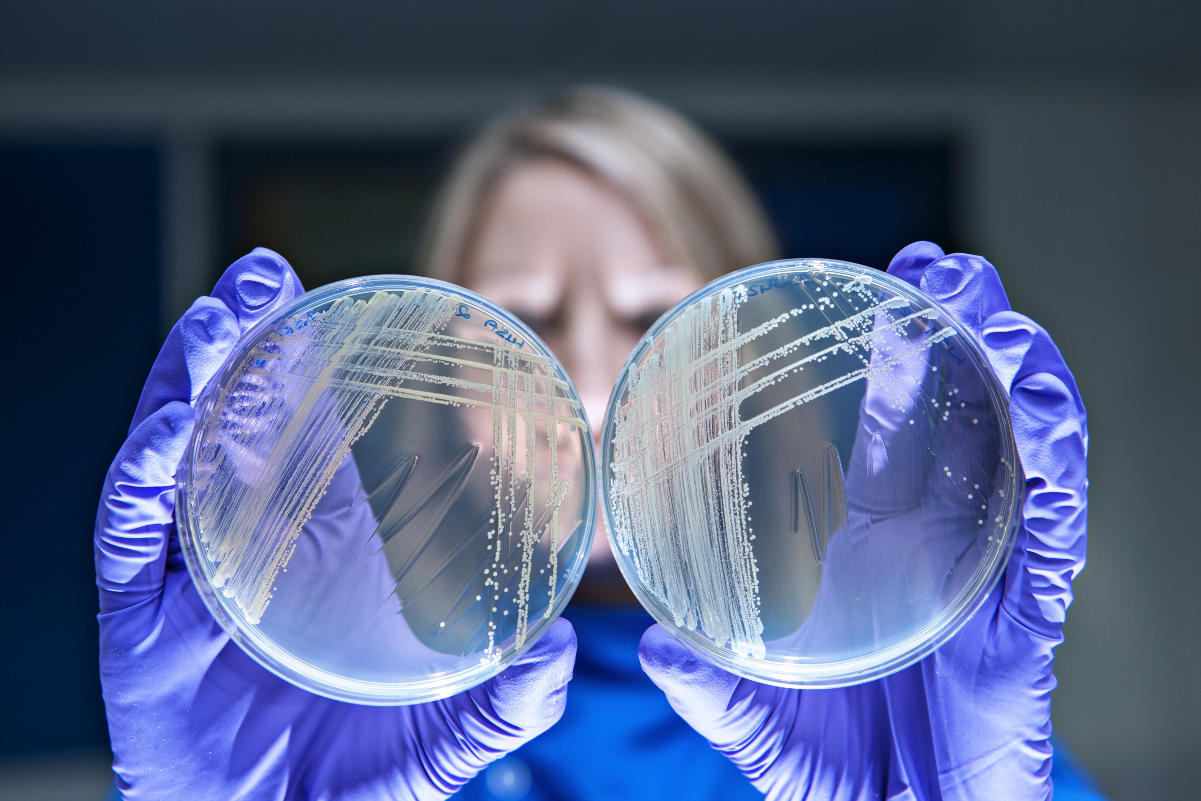 אחד הסיכונים הגדולים ביותר לבריאות האדם. תרביות של חיידקים עמידים לאנטיביוטיקה | צילום: Science Photo Library