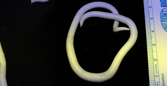 האם זו התולעת העגולה הגדולה שתיאר היפוקרטס? תולעת מעיים מהסוג אסקריס | צילום: CDC, ויקיפדיה, נחלת הכלל