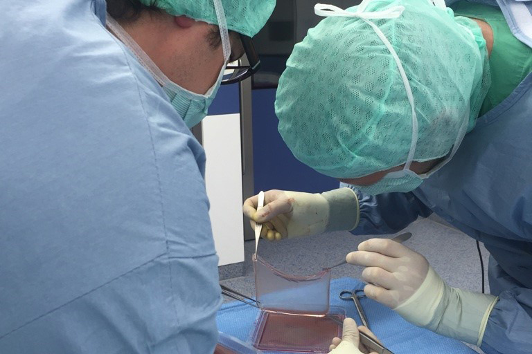 חיים חדשים. פיסה מהעור המהונדס באחד מניתוחי ההשתלה שעבר חסן | צילום: אוניברסיטת הרוהר, בוכום