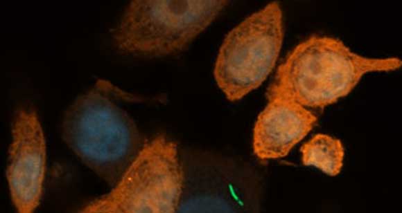 משפיעים על העמידות לכימותרפיה. חיידקים (בירוק) בתוך תא לבלב סרטני | צילום: ליאור גלר, מכון ויצמן למדע