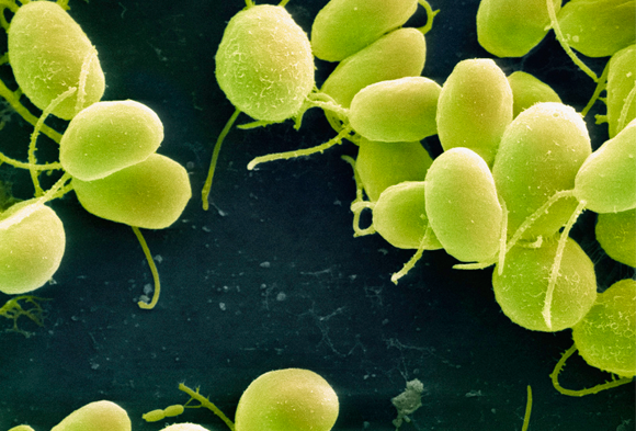 אצות Chlamydomonas reinhardtii בצילום (צבוע) במיקרוסקופ אלקטרונים סורק| מקור: ויקיפדיה (Dartmouth Electron Microscope Facility)