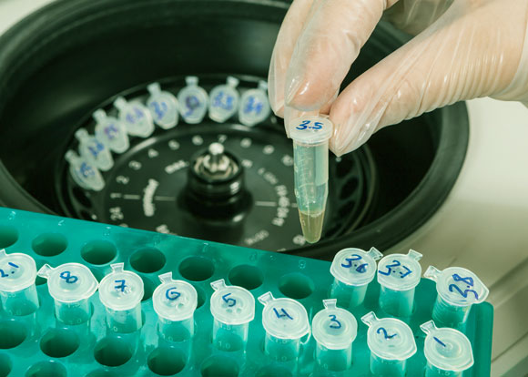 בקהילות קטנות וסגורות שכיחות הנשאות של מחלות גנטיות ושל מומים מולדים עלול להיות גבוה מאוד. מעבדה גנטית | צילום: Shutterstock