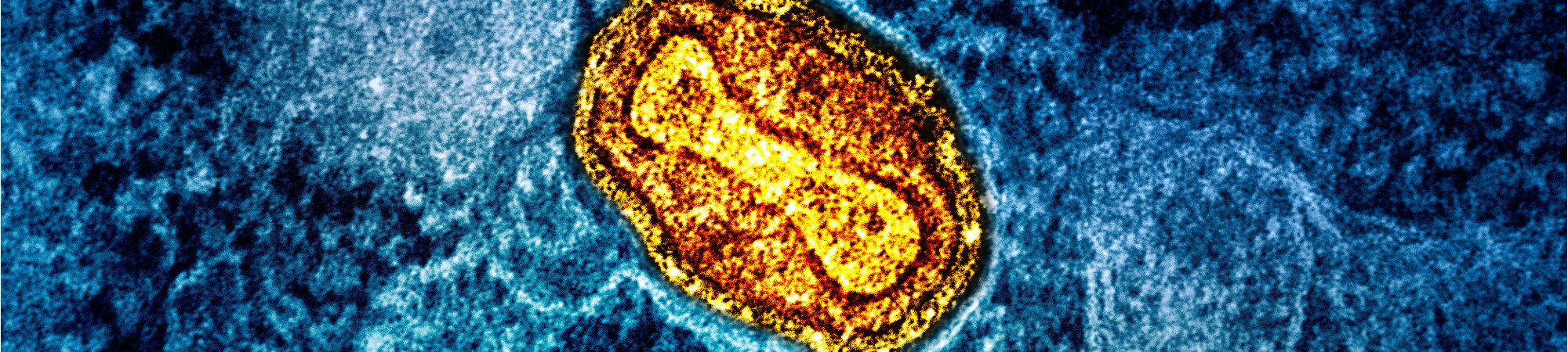 جدري القرود: حالة طوارئ عالميّة مجدّدًا